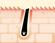 カミソリ処理後のイメージ