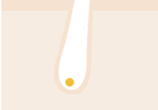 Removes hair from pores