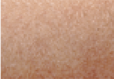 White powdery surface and the skin looks dry