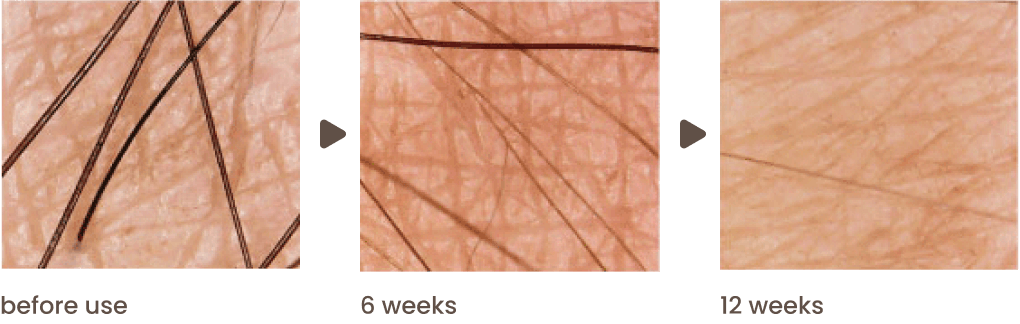 before use - 6 weeks - 12 weeks