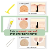 DIY Hair Removal set - Cream(230g) and Lotion(100mL), use in conjunction for best results, all skin types