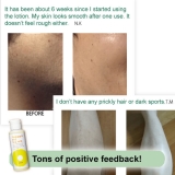 DIY Hair Removal set - Cream(230g) and Lotion(100mL), use in conjunction for best results, all skin types